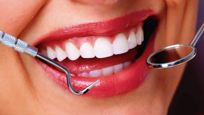 Dental Implants