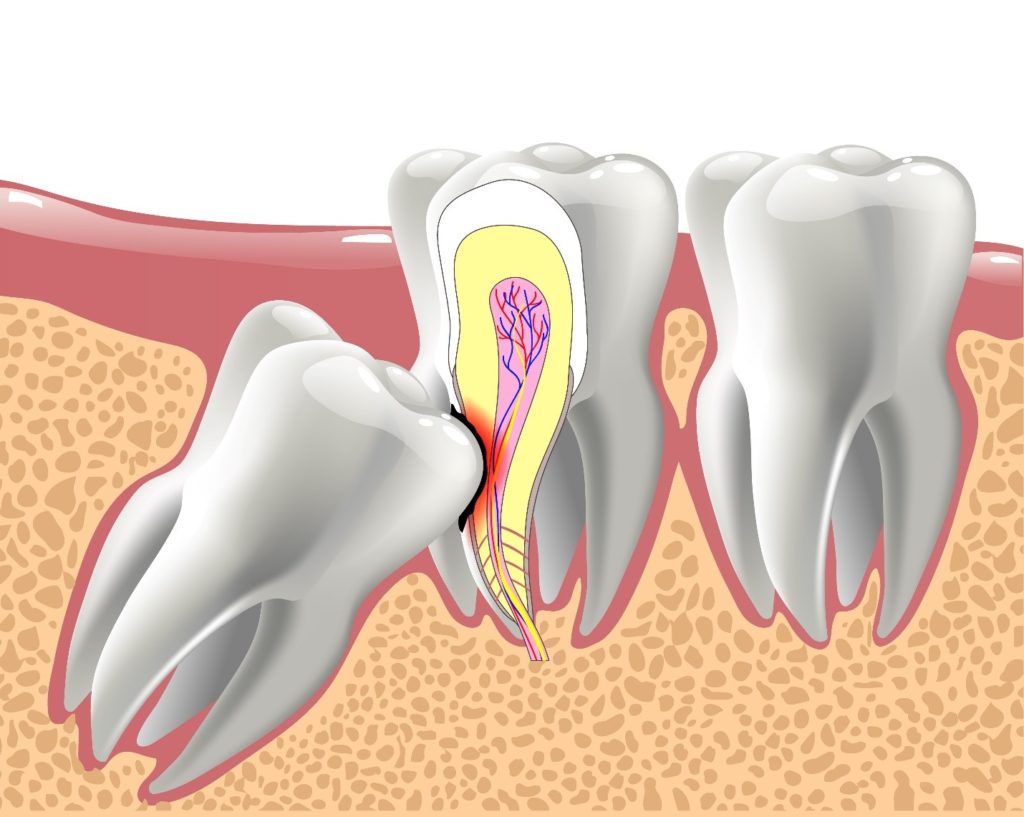 Cirugía Oral y Maxilofacial